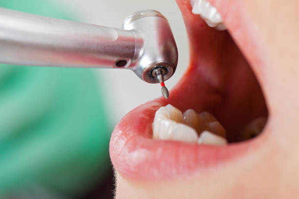 Best Emergency Denture Repair in Wade Hampton, SC